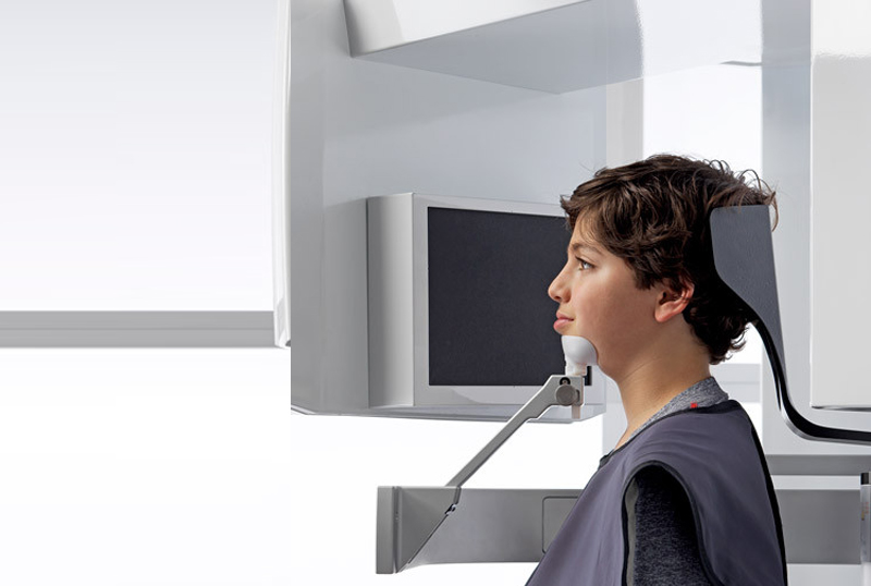 Cone Beam 3D (CBCT Scan)