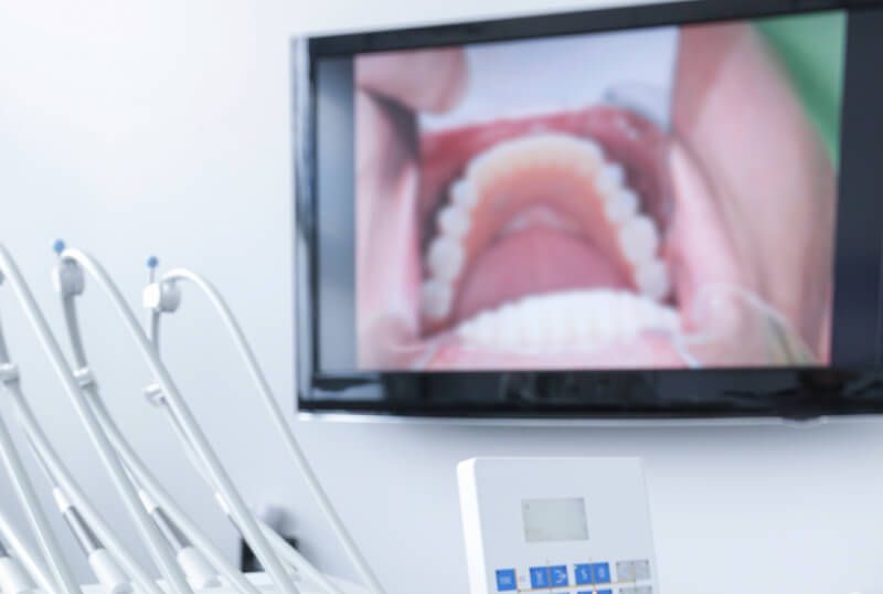 Intraoral Camera
