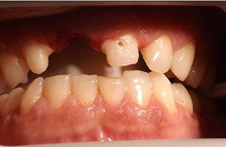 Smile Gallery - Before