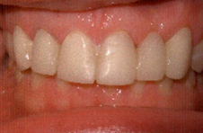 Smile Gallery - Before