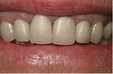 Smile Gallery - Before