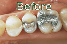 Smile Gallery - Before