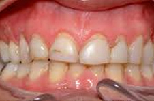 Smile Gallery - Before