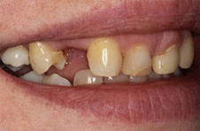 Smile Gallery - Before