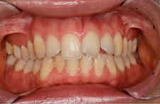 Smile Gallery - Before