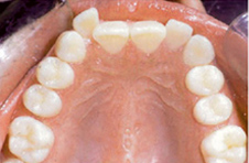 Smile Gallery - Before