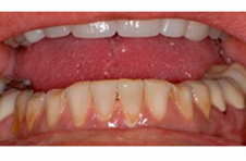 Smile Gallery - Before