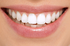 Smile Gallery - After