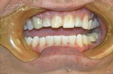 Smile Gallery - Before