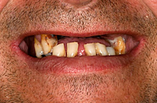 Smile Gallery - Before