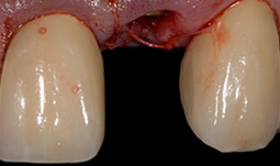 Smile Gallery - Before