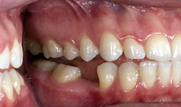 Smile Gallery - Before