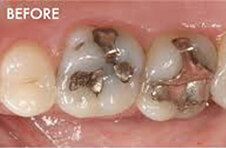 Smile Gallery - Before