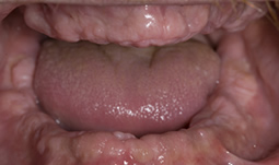 Smile Gallery - Before