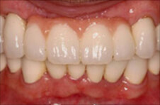 Smile Gallery - After