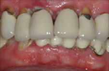 Smile Gallery - Before