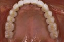 Smile Gallery - After