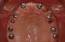 Smile Gallery - Before