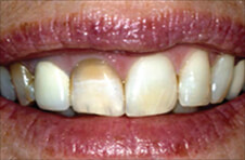 Smile Gallery - Before