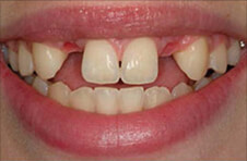 Smile Gallery - Before