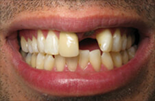 Smile Gallery - Before