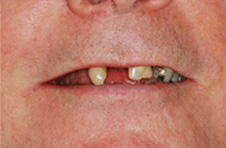 Smile Gallery - Before