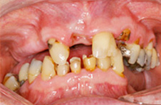 Smile Gallery - Before