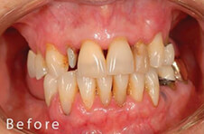 Smile Gallery - Before